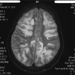 Как часто можно делать МРТ головного мозга