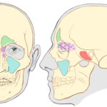 Что лучше сделать МРТ или КТ придаточных пазух носа?