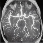 Основные и показания и противопоказания к МРТ головного мозга